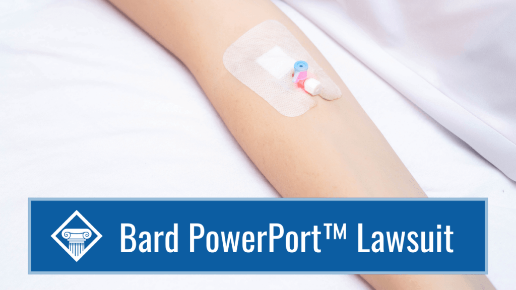 Bard Powerport Catheter Lawsuit