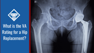 An X-ray of an individual's pelvis with a prosthetic hip. Alongside the image is a blue banner reading the article title: What is the VA rating for a hip replacement?