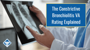 An image of a person gesturing to an Xray of a patient's chest. Over the image is a blue box reading the article title: The constrictive bronchiolitis VA rating explained