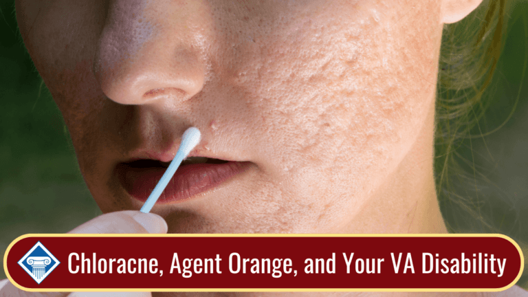 Close-up photo of a woman's face with acne holding a cotton swab. Article title is across the bottom: chloracne, Agent Orange, and your VA benefits.