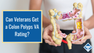 Photo of a woman in a white shirt holding a plastic diagram of the colon. Article title is to the left: Can veterans get a colon polyps VA rating?