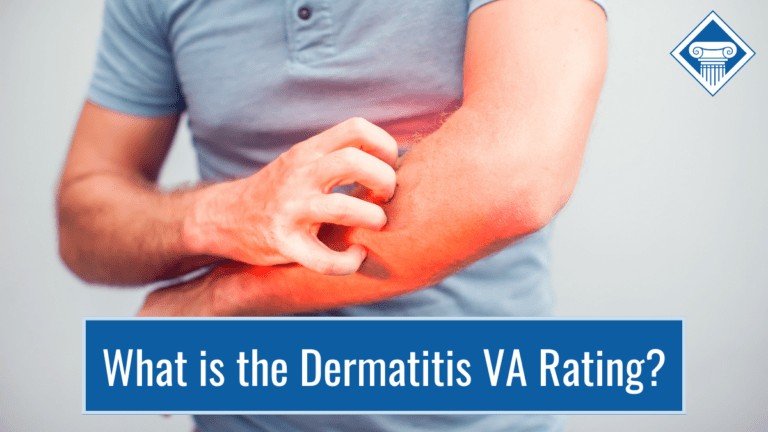 A man in a blue shirt is scratching his arm. The affected part of his arm is highlighted in red. Article title runs across the bottom of the image: What is the dermatitis VA rating?