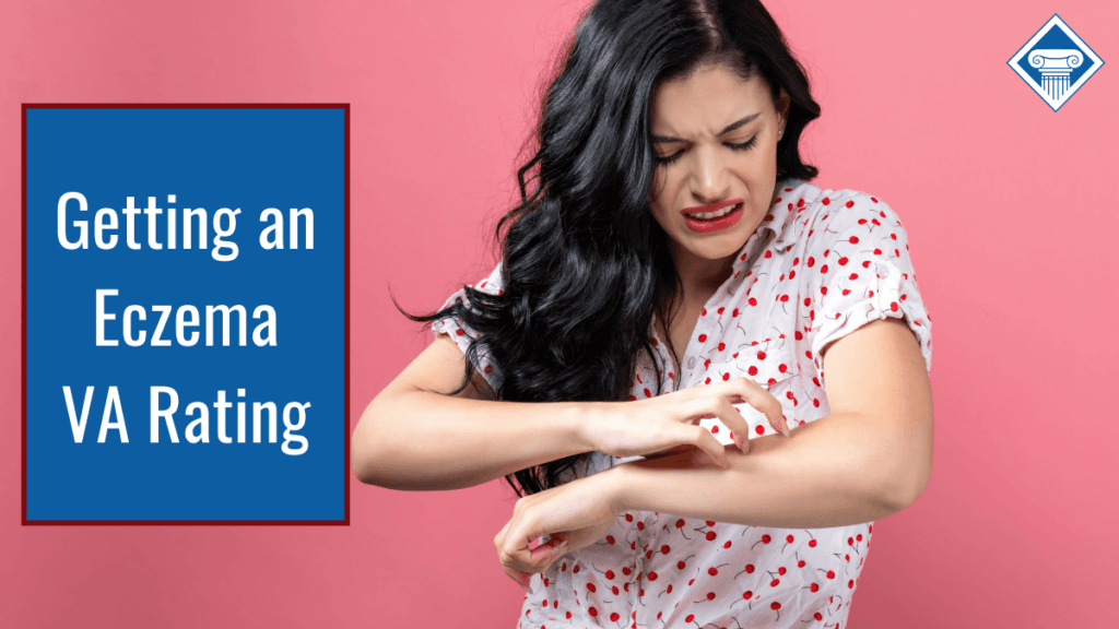 Article title is on the left: Getting an Eczema VA Rating. A woman with long brown hair and a white and red shirt is scratching her arm and grimacing. 