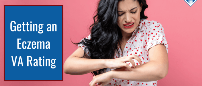 A woman with long brown hair and a white and red shirt is scratching her arm and grimacing. Article title is on the left: Getting an Eczema VA Rating