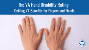 An image of a Caucasian person's hands spread out palm-down on a white surface. Along the top of the image is a blue banner reading the article title: The VA Hand Disability Rating: Getting VA benefits for fingers and hands