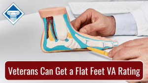 Photo of an anatomical model of a foot and a doctor's hands pointing with a yellow pen to the foot's arch. Article title is across the bottom: Veterans Can Get a Flat Feet VA Rating