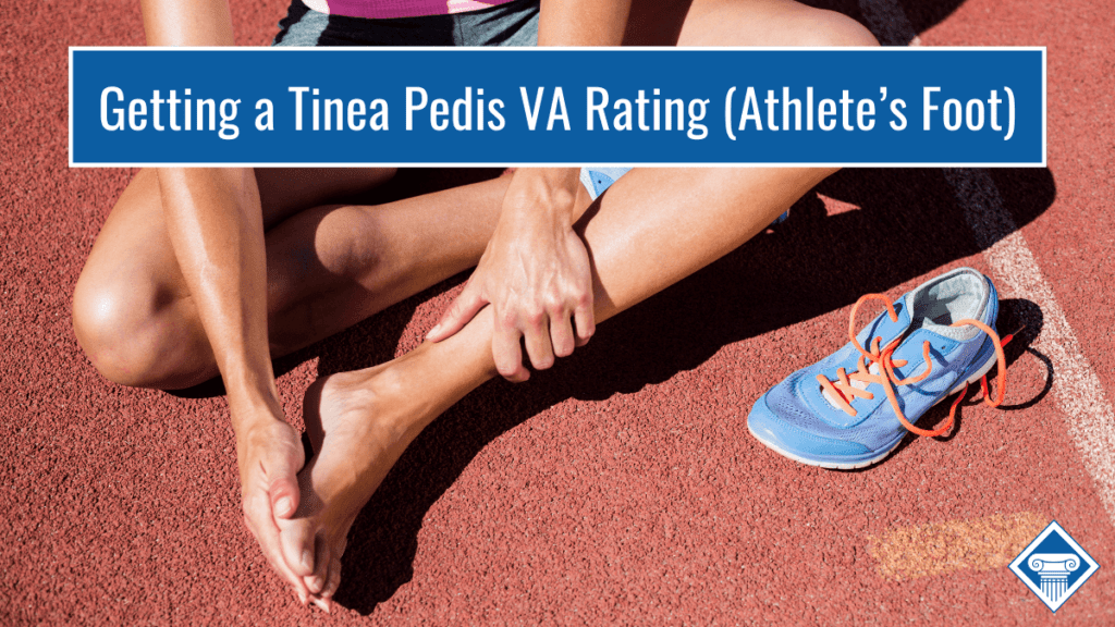 Picture of a runner itching their feet with a title at the top: Getting a Tinea Pedis VA Rating (Athlete's Foot).