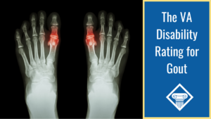 An image of an Xray of feet with inflammation in the joints. Over the image is a blue box reading the article title: the VA disability rating for gout.