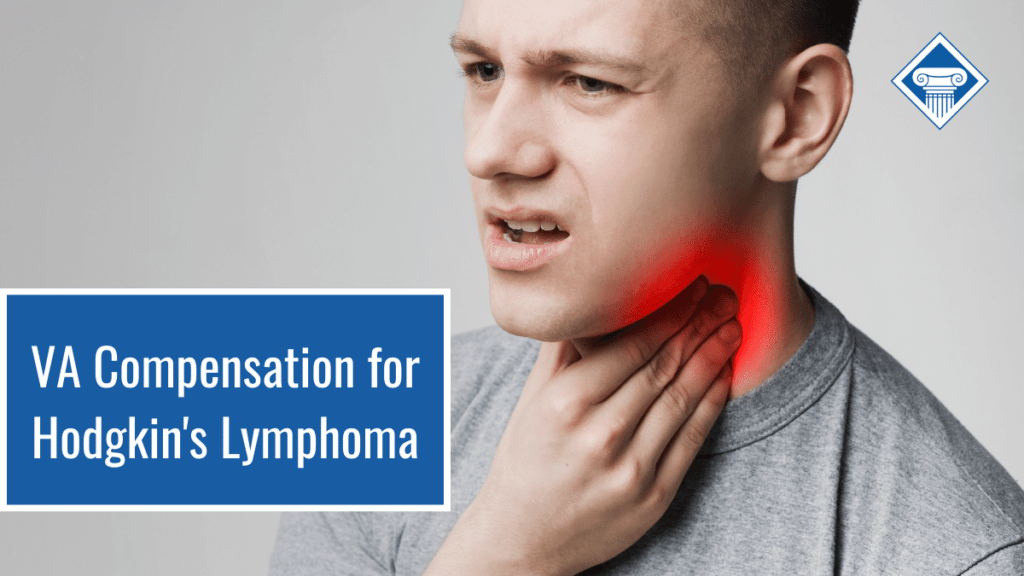 Man holding his throat which appears to be red with pain. Article title is on the left: VA compensation for Hodgkin's lymphoma.