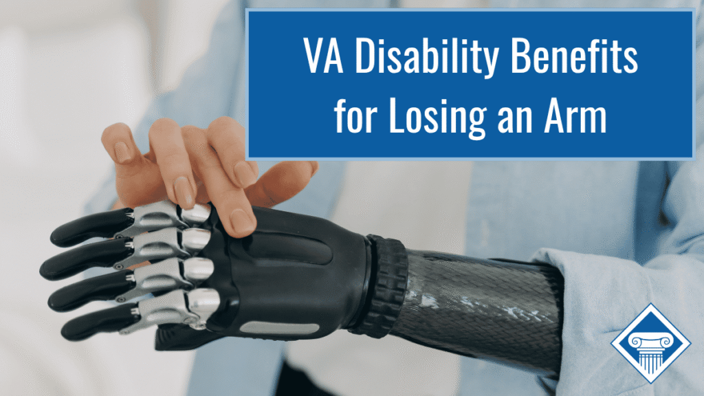 Photo of a person with a blue linen shirt on bending their arm to show that it's a prosthetic and touching it with their other hand. Article title is in the upper right hand corner: VA disability benefits for losing an arm