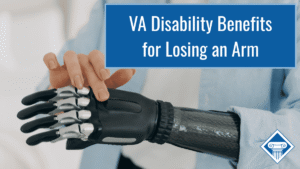 Photo of a person with a blue linen shirt on bending their arm to show that it's a prosthetic and touching it with their other hand. Article title is in the upper right hand corner: VA disability benefits for losing an arm