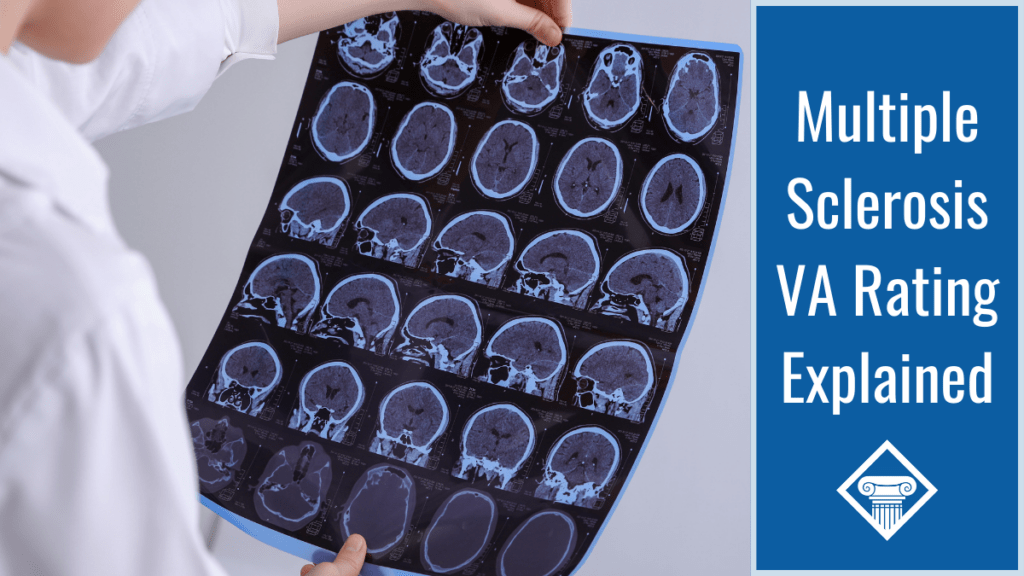Doctor looking at brain x-rays with our title on the right side: Multiple Sclerosis VA Rating Explained
