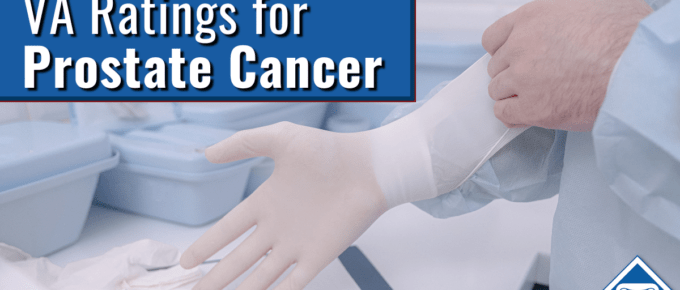 Text: VA Ratings for Prostate Cancer Image: Doctor putting on glove