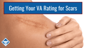 Picture of a person holding their shoulder. Their hand is next to a large scar. Article title is across the top: Getting Your VA Rating for Scars