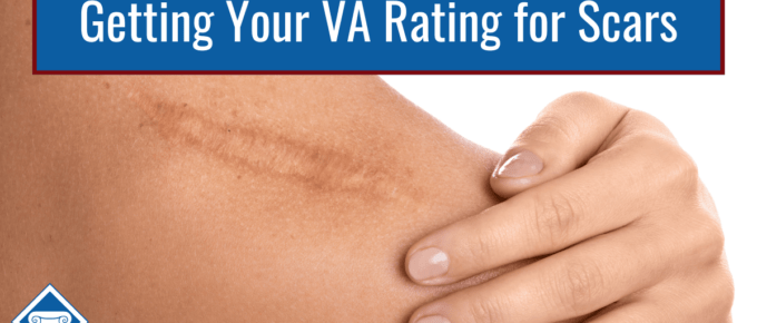 Picture of a person holding their shoulder. Their hand is next to a large scar. Article title is across the top: Getting Your VA Rating for Scars