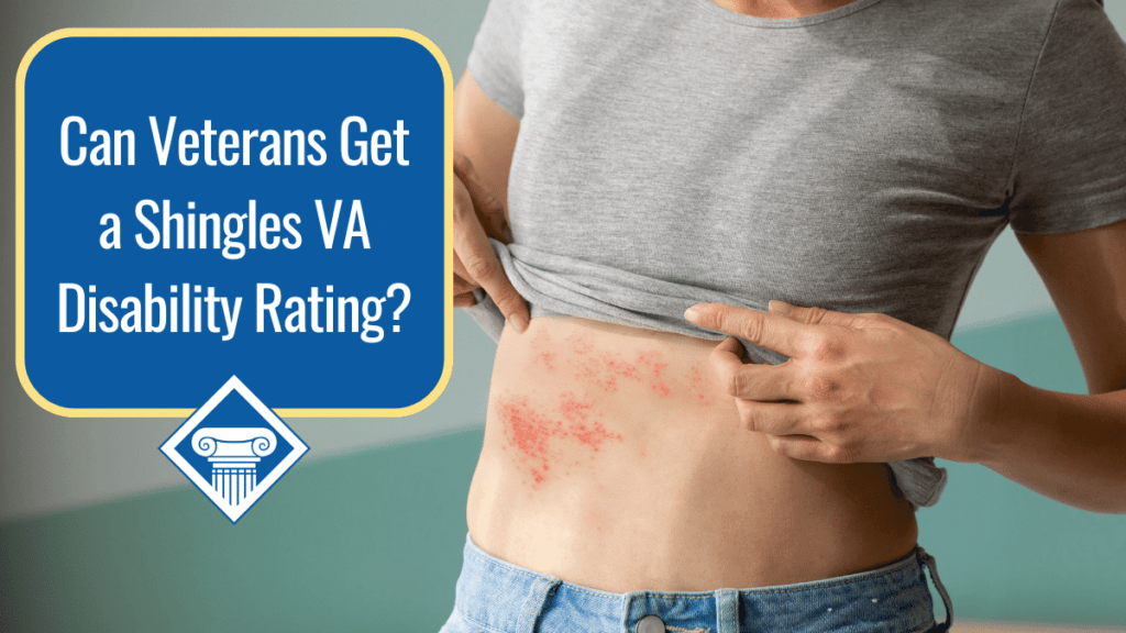 A person wearing a grey T-shirt lifts their shirt to show a red rash on their stomach. Over the image is a blue box reading the article title: Can veterans get a shingles VA disability rating?