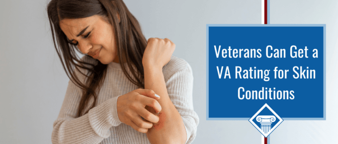 A brunette woman wearing a tan sweater grimaces while scratching her forearm, which is inflamed. Article title is to the right: Veterans Can Get a VA Rating for Skin Conditions