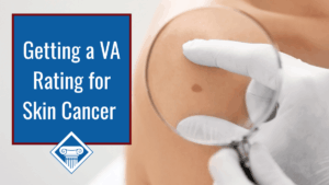 A person wearing white gloves looks at a patient's mole under a magnifying glass. Over the image is a blue box with a red border reading the article title: Getting a VA rating for skin cancer