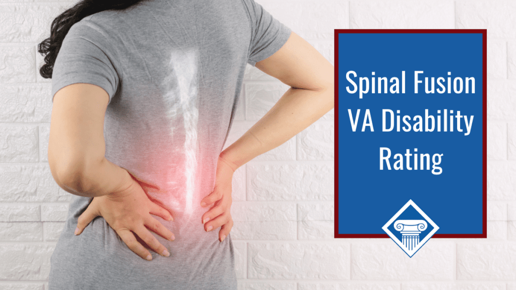 A woman in a grey t-shirt holds her back, which is radiating pain in her spine. Over the image is a blue box with a red border reading the article title: Spinal fusion VA disability rating