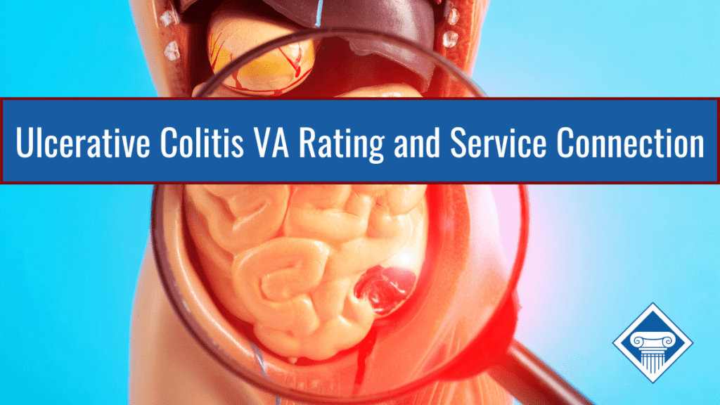 A diagram of an individual's digestive tract with an inflamed red area under a magnifying glass. Over the image is a blue banner reading the article title: Ulcerative colitis VA rating and service connection