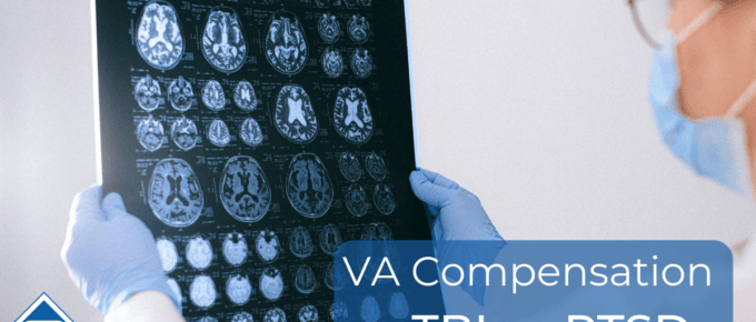 Doctor holding an MRI scan of brain images. Article title is on the right; VA compensation for TBI and PTSD