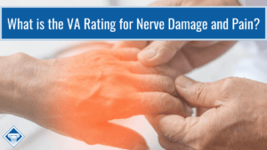 A picture of a doctor touching the fingers of a patient. The patients hand and fingers are highlighted in transparent red to signify nerve damage or pain. Article title is in blue across the top of the picture: What is the VA rating for nerve damage and pain?