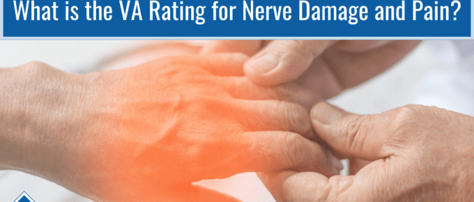 A picture of a doctor touching the fingers of a patient. The patients hand and fingers are highlighted in transparent red to signify nerve damage or pain. Article title is in blue across the top of the picture: What is the VA rating for nerve damage and pain?