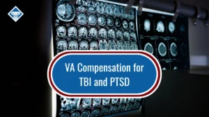 A medical film shows a brain scan under the caption: VA compensation for TBI and PTSD.