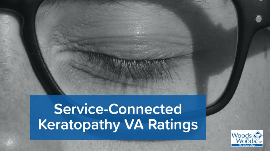 Black and white picure of a close-up on a man's eye (wearing glasses) and his eye is closed. Our title is below his eye: Service-Connected Keratopathy ratings