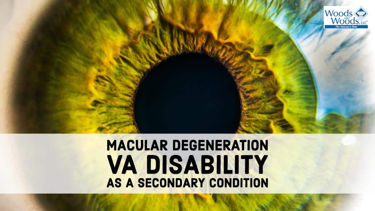 Yes, I Can! - Handling Macular Degeneration