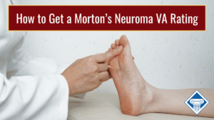 Photo of a doctor wearing a white coat touching a person's foot, which is propped up on a table. Article title is across the top: How to Get a Morton's Neuroma VA Rating