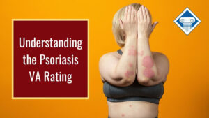 Photo of a woman wearing a sports bra with her forearms and hands up covering her face to reveal psoriasis on her forearms and stomach. Article title is to the left: Understanding the psoriasis VA rating