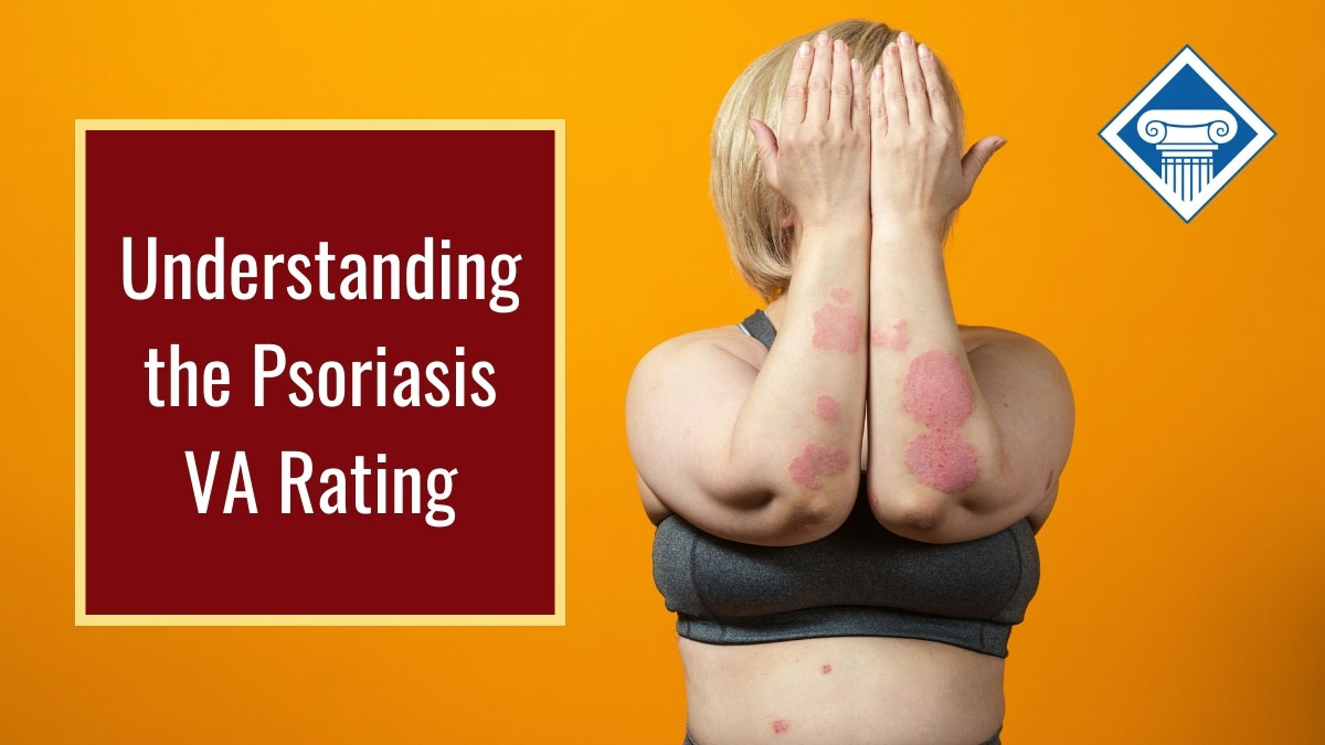 Photo of a woman wearing a sports bra with her forearms and hands up covering her face to reveal psoriasis on her forearms and stomach. Article title is to the left: Understanding the psoriasis VA rating
