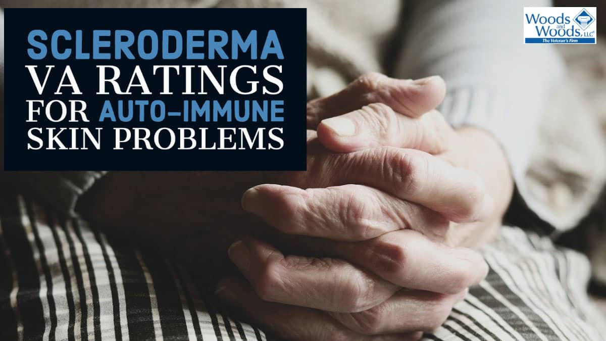 Picture of old hands with swollen knuckles on a lap. Our title is in the top left: Scleroderma VA Ratings for Auto-Immune Skin Problems