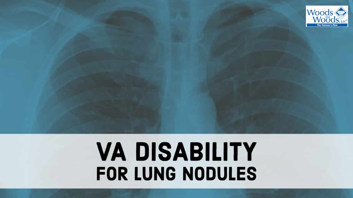 Picture of a lung X-ray with a blue tint to it. Our title appears in front "VA Disability for Lung Nodules."