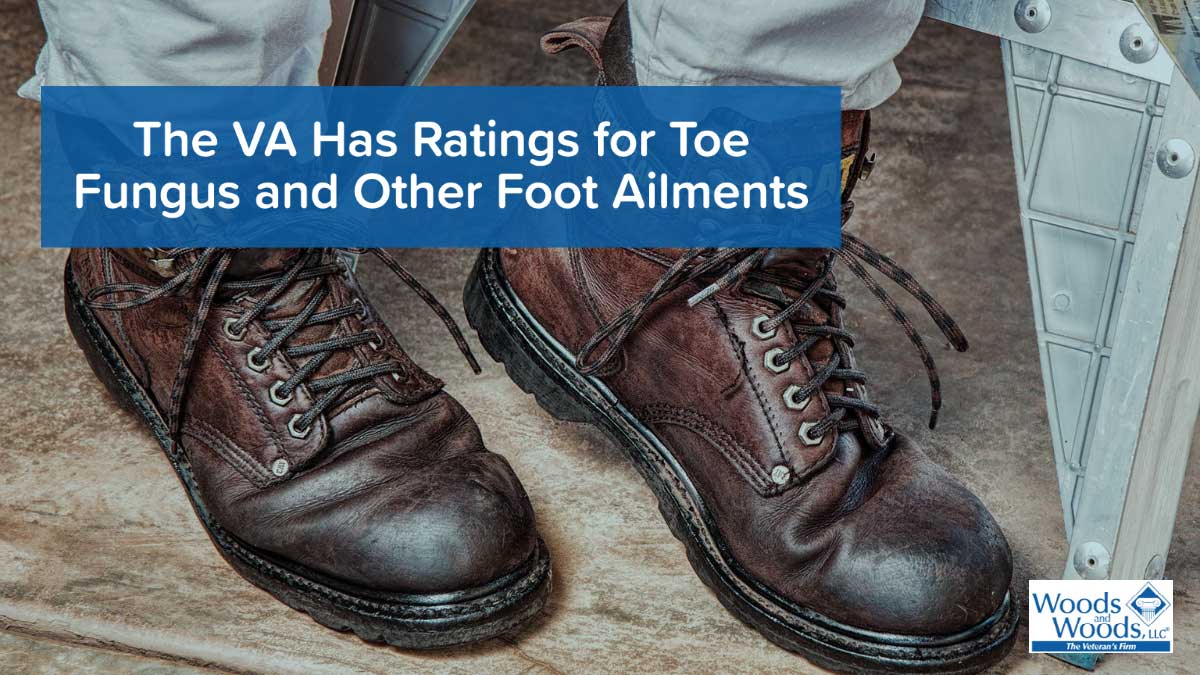 Picture of a person in some well-worn work boots and khaki pants. Our title is in white letters on a blue background in the top corner: The VA Has Ratings for Toe Fungus and Other Foot Ailments