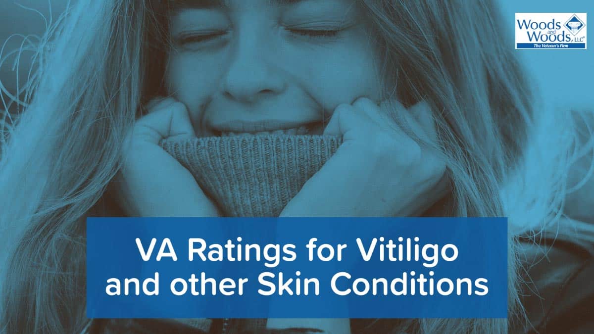 Picture in blue tones of a woman covering her neck and the lower part of her face with a sweater. Her eyes are closed and her hands are in her face. Our title shows below: VA Ratings for Vitiligo and Other Skin Conditions